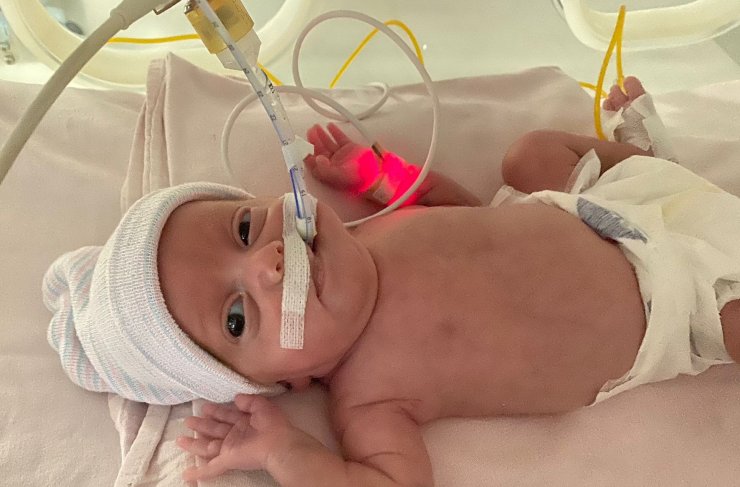 540 gramlık parmak bebek Rabia'yı kök hücre tedavisi hayata bağladı