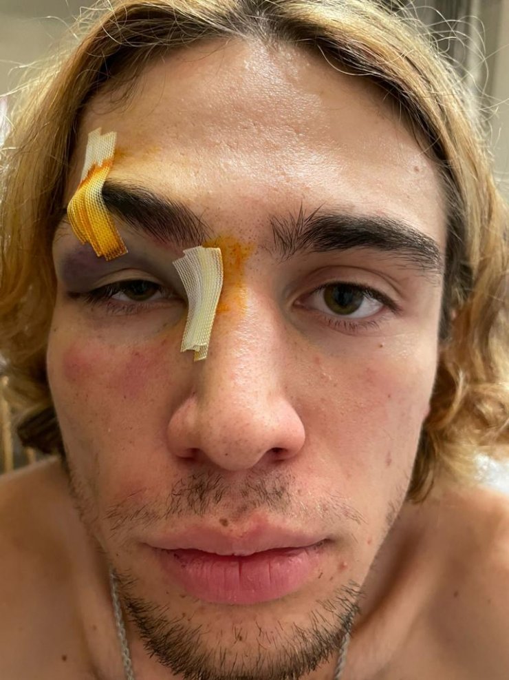 Maltepe'de kaykay şampiyonu milli sporcuya dayak