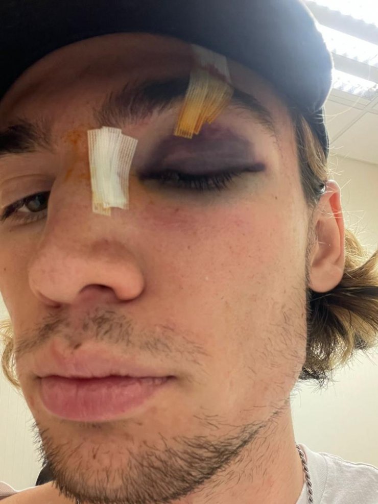 Maltepe'de kaykay şampiyonu milli sporcuya dayak