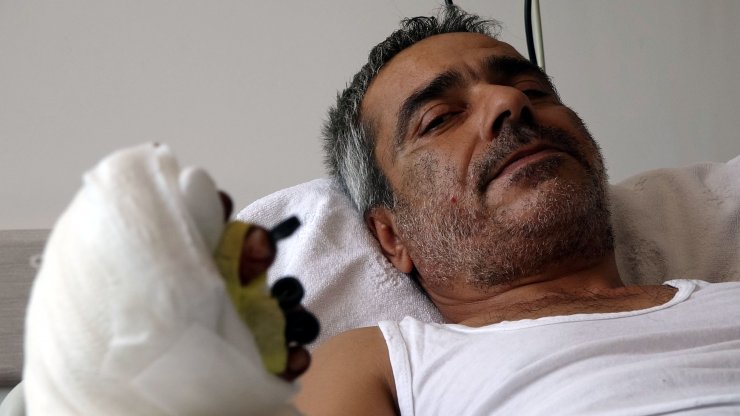 Kopan parmaklarını poşetle hastaneye götürdü, 12 saatte dikildi