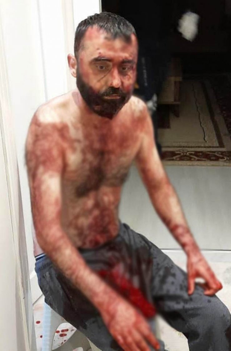 Meral ile 10 günlük eşini falçatayla yaralayan eski kocaya 40 yıla kadar hapis istemi