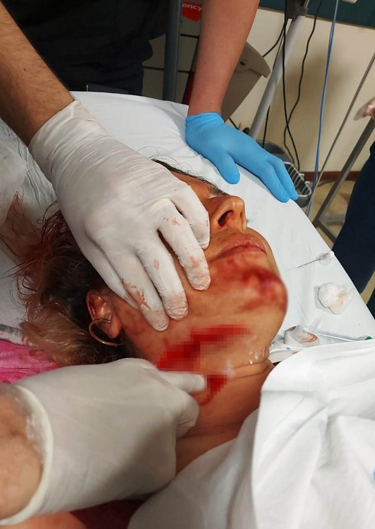 Meral ile 10 günlük eşini falçatayla yaralayan eski kocaya 40 yıla kadar hapis istemi