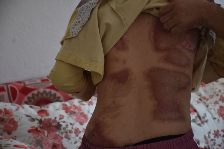 Yangında balkondan atlayınca komşunun kurtardığı kadın: Hayatımı borçluyum