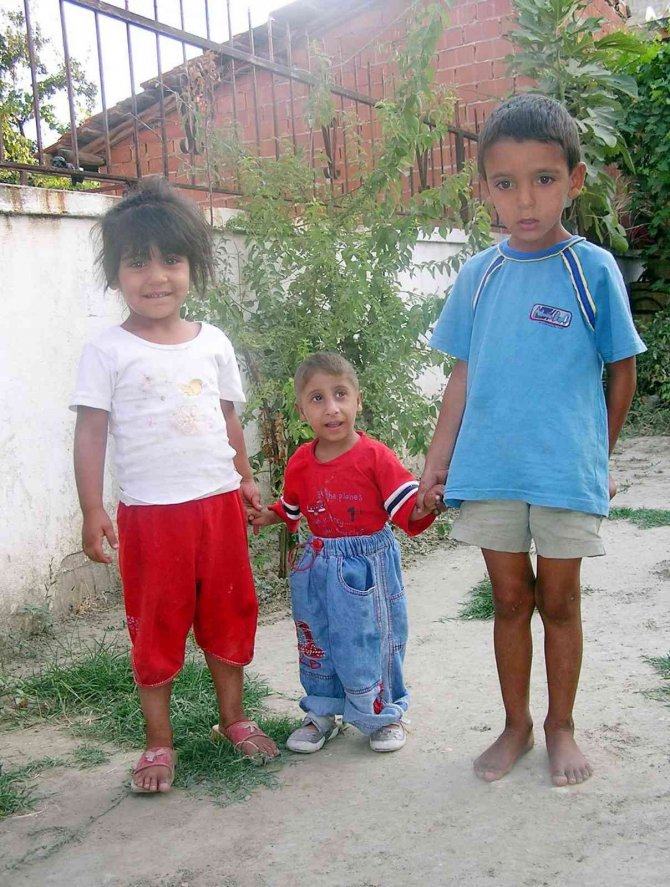 ‘Parmak çocuk’ vefat etti