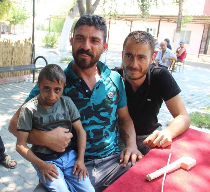 ‘Parmak çocuk’ vefat etti