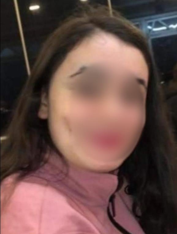 3 gündür kayıp olan zihinsel engelli kadın sahilde bulundu, yanındaki kişi gözaltına alındı