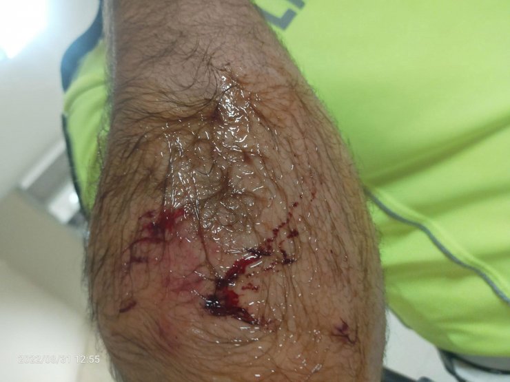 Alkollü sürücü ehliyetini isteyen polise yasaklı köpeğini saldırttı