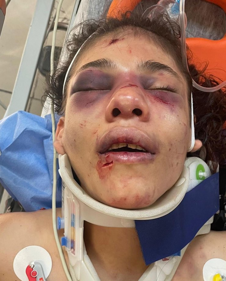 Havva'yı 51 bıçak darbesi ile yaralayan şüpheli tutuklandı