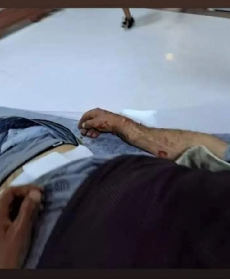 Yaylada ayı saldırısına uğrayan çoban yaralandı