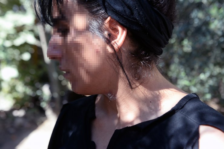 Ayrılmak isteyen sevgilisini dövüp, evi ateşe verdi