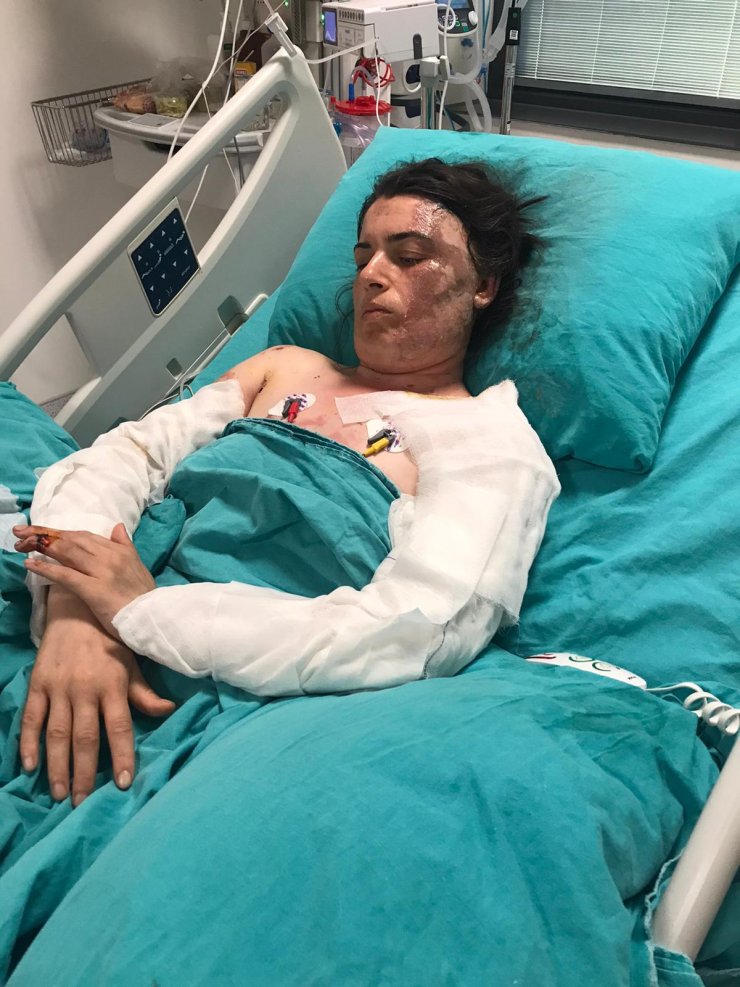 Eski elti dehşeti: 17 kez bıçaklayıp, üzerine kaynar su döktü