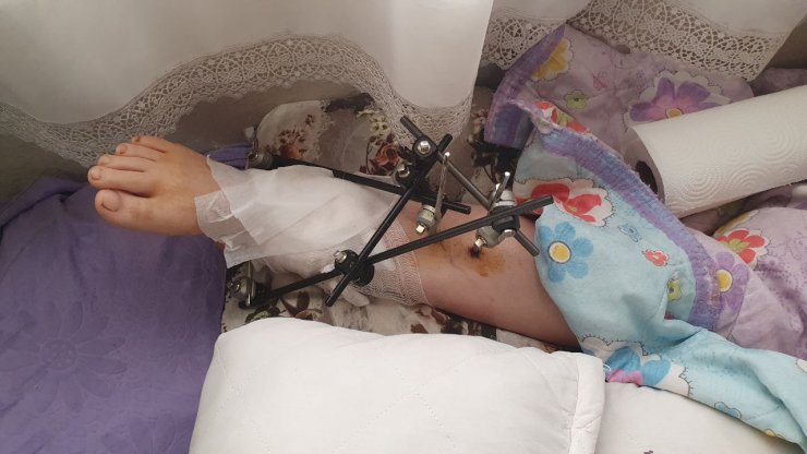 17 yaşındaki oğlunun tüfekle vurduğu anne: Sakat kalmak istemiyorum