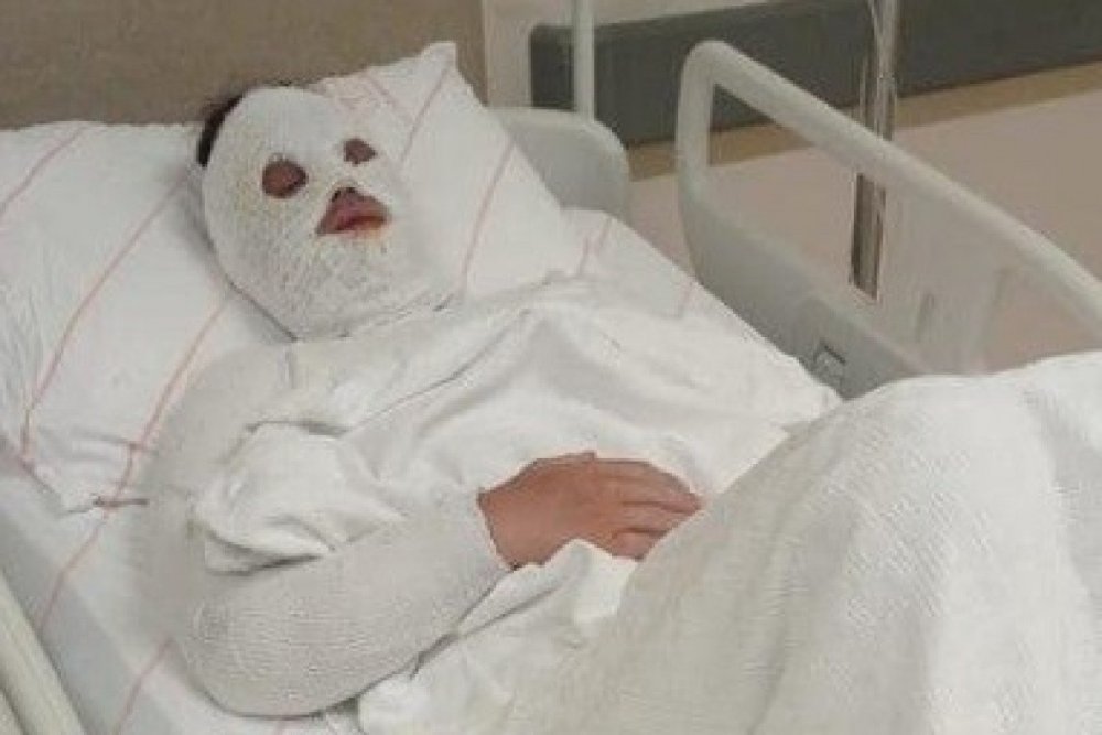 Konya'da eski nişanlısına kimyasal sıvı atan kişinin iddianamesi kabul edildi! Verilecek karar Türkiye'de ilk olabilir