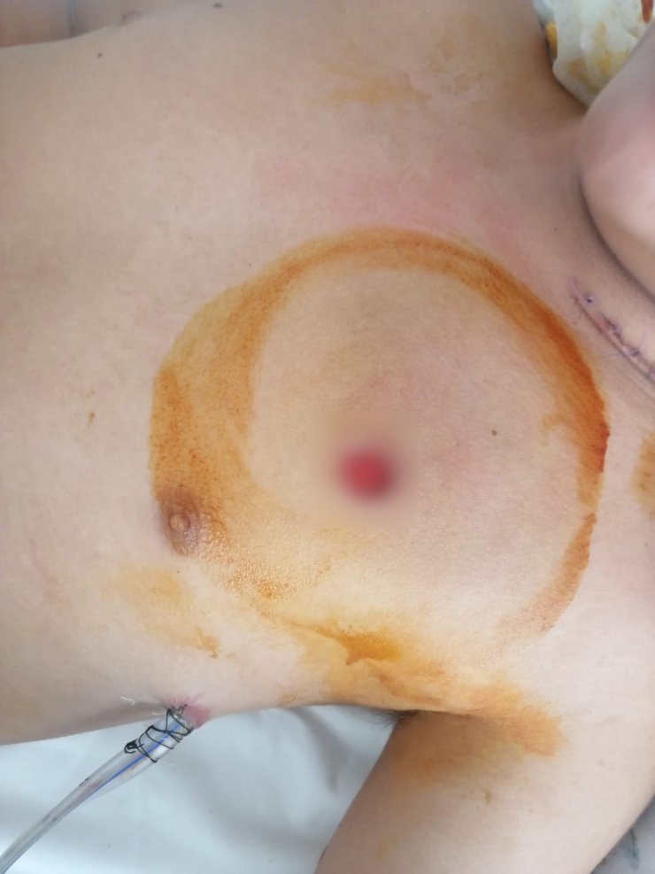 Satırlı saldırının sanığı avukatı olmadığı gerekçesiyle savunma yapmadı