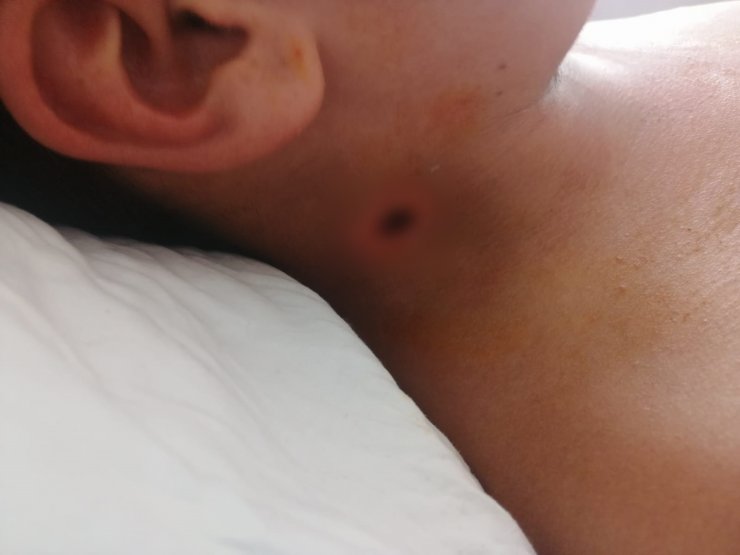 Satırlı saldırının sanığı avukatı olmadığı gerekçesiyle savunma yapmadı