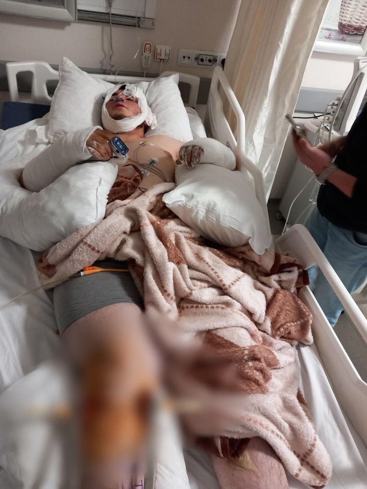 Sancaktepe'de otomobilin çarptığı motosikletli ağır yaralandı