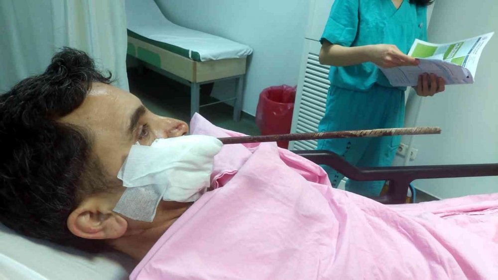 Yüzüne saplanan demirle hastaneye kaldırıldı