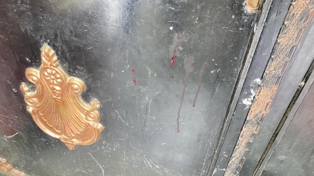 Boşanma aşamasındaki eşinin yüzünü bıçakladı