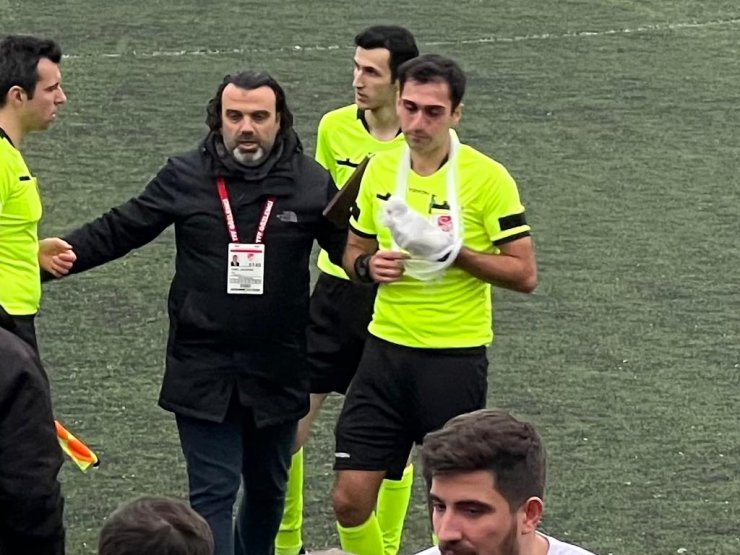 Parmağı kırılan hakem elinde bandajla maç yönetti