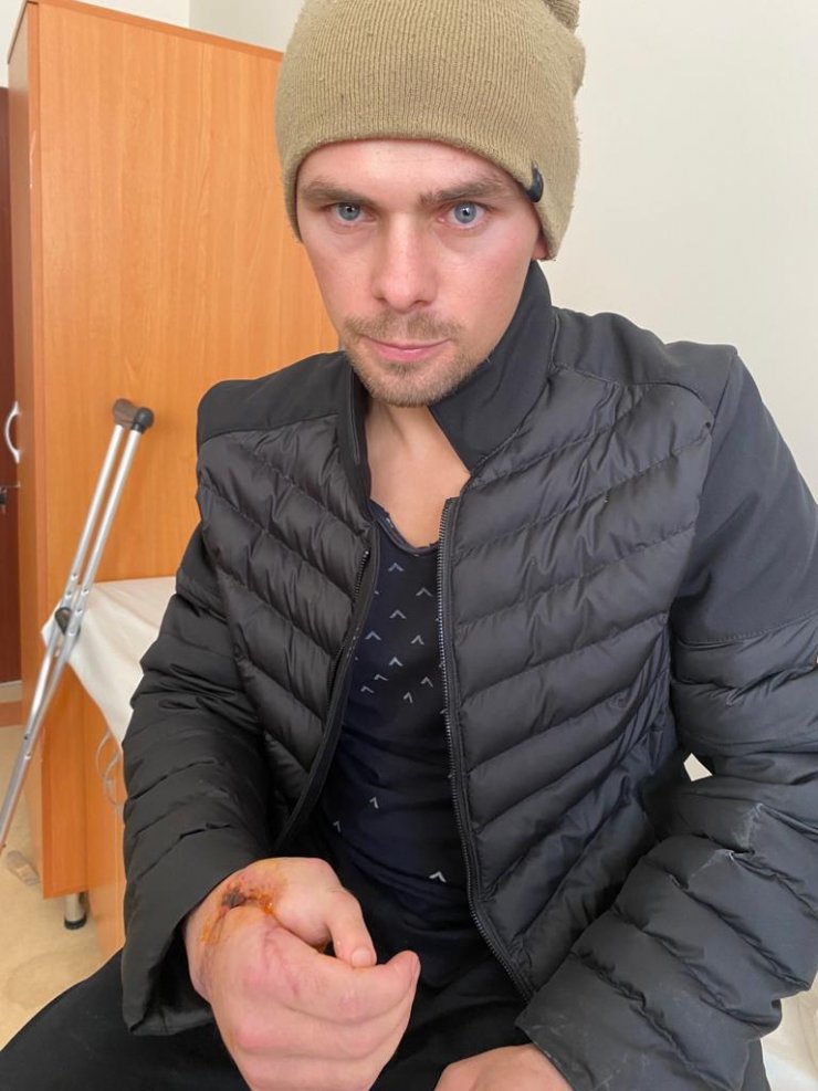 Konya'da elini demir kesme makinesine kaptıran Yunus'un kopan el parmağı yerine ayak parmağı dikildi