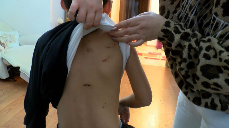 Okula giden çocuğa sokak köpekleri saldırdı