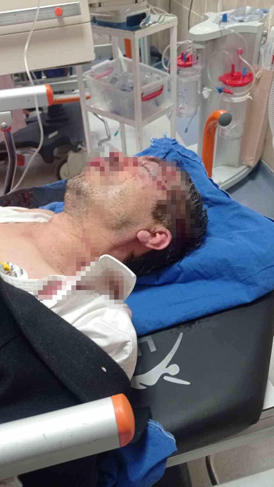 Ziraat Odası Sekreteri’ne evinin önünde saldırı