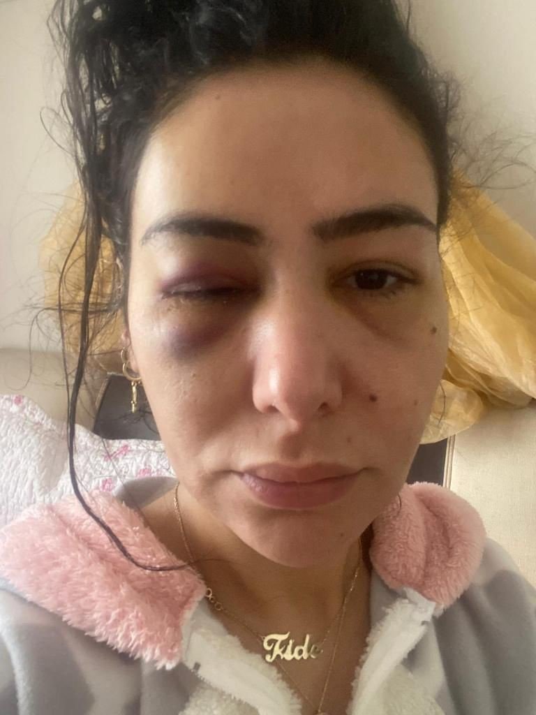 Darp eden şahıs serbest kalınca panik butonu verildi