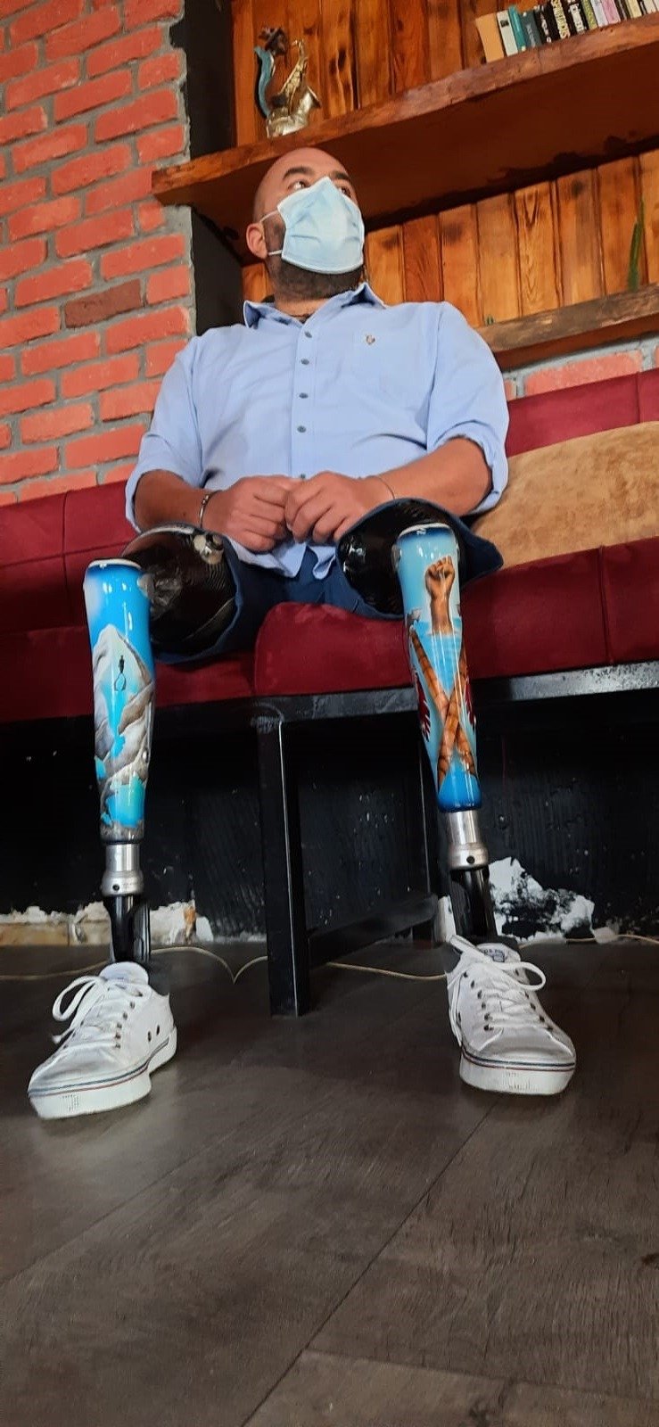 17 Ağustos'ta iki bacağını kaybetti, depremzedelere destek için Hatay'a gitti