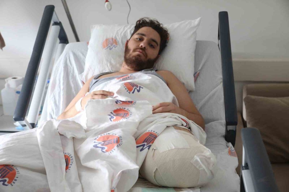 Kardeşini kurtarmak için ayağını kaybetti