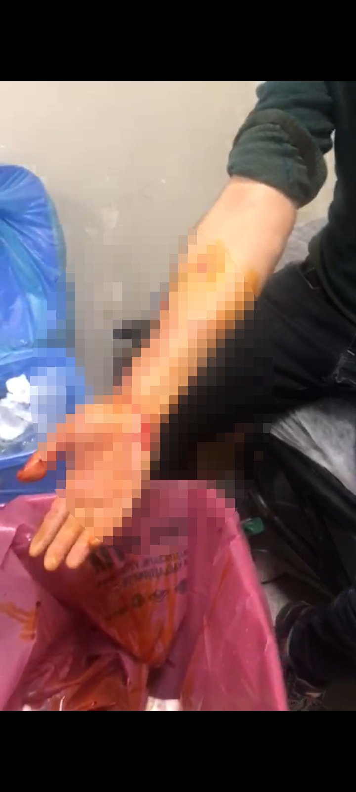 Sayaç okumaya giden çalışana köpek saldırdı