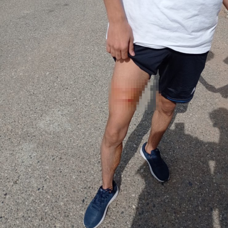 Okul bahçesinde sahipsiz köpeğin saldırdığı öğretmen ile öğrencisi yaralandı