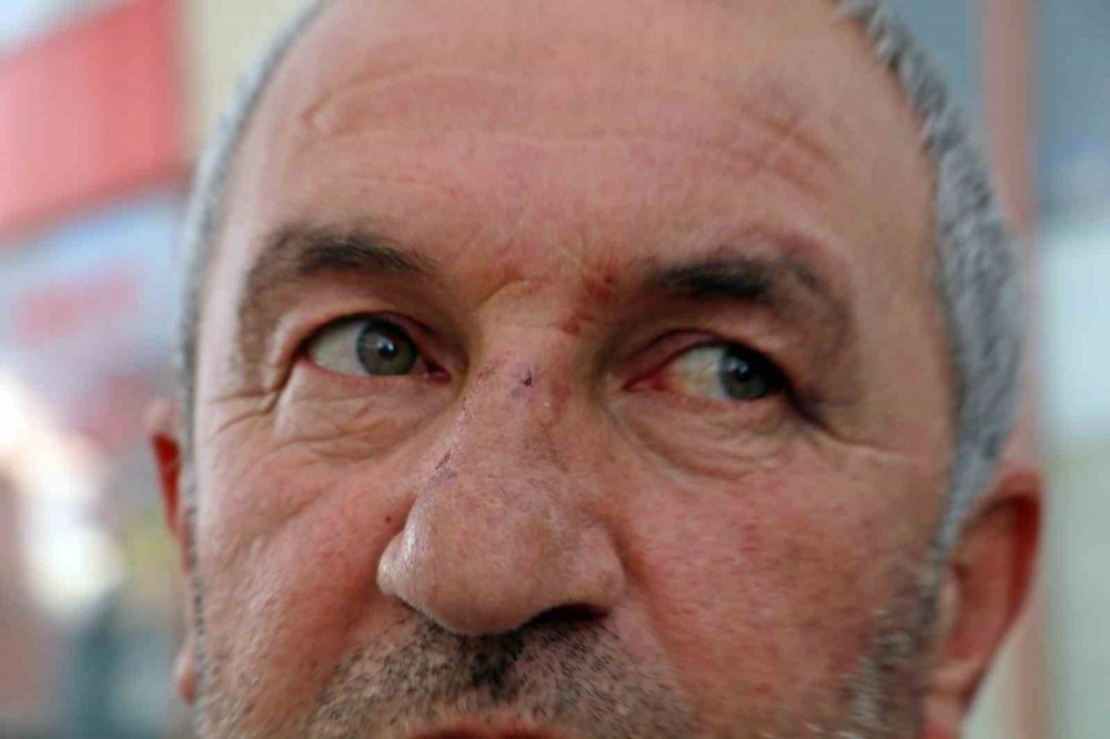 Kulak zarını patlatana kadar dövdüler, yanlış adamı dövdüklerini fark edince kaçtılar!