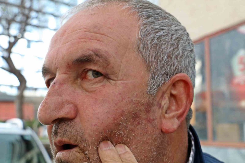 Kulak zarını patlatana kadar dövdüler, yanlış adamı dövdüklerini fark edince kaçtılar!