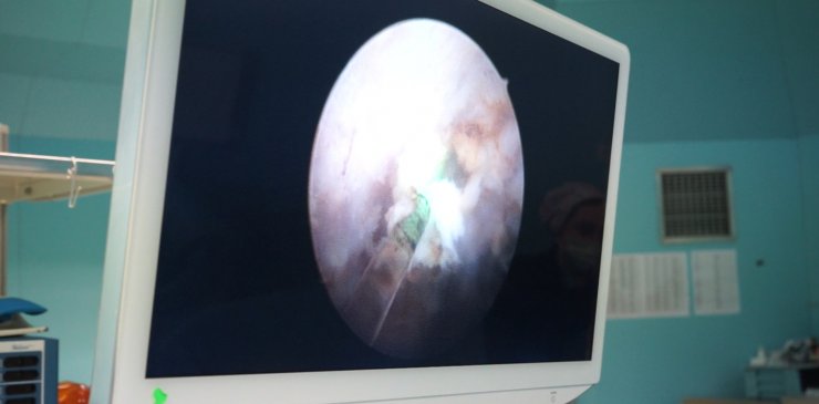 Korkusu ameliyat olmasına engel olmuştu, 1 saatte kurtuldu