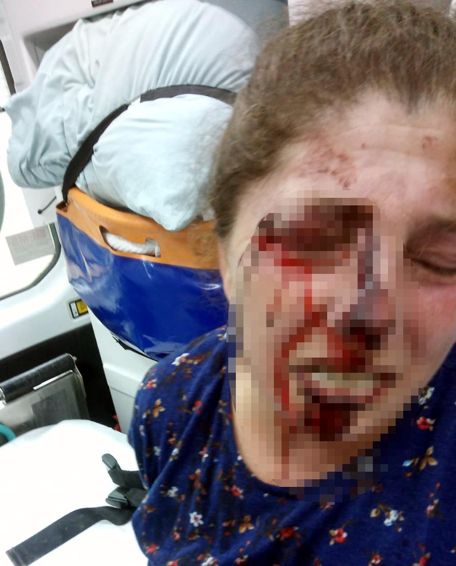 Husumetli olduğu akrabası baba-oğulun baltalı saldırısında yaralandı