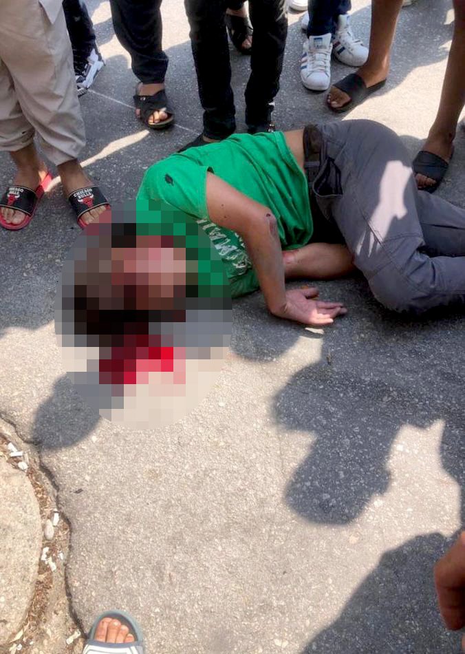 Aynı caddede 2 gün arayla silahlı saldırı; bu kez genç Mehmet'i vurdular