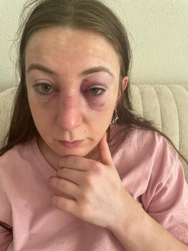 Sibel'i dövüp, ölümle tehdit eden eski sevgilisi yakalandı