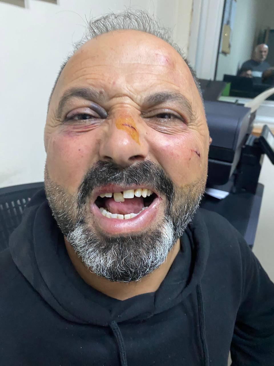 Konya'da baba ve oğula 'Ne bakıyorsun' dayağı