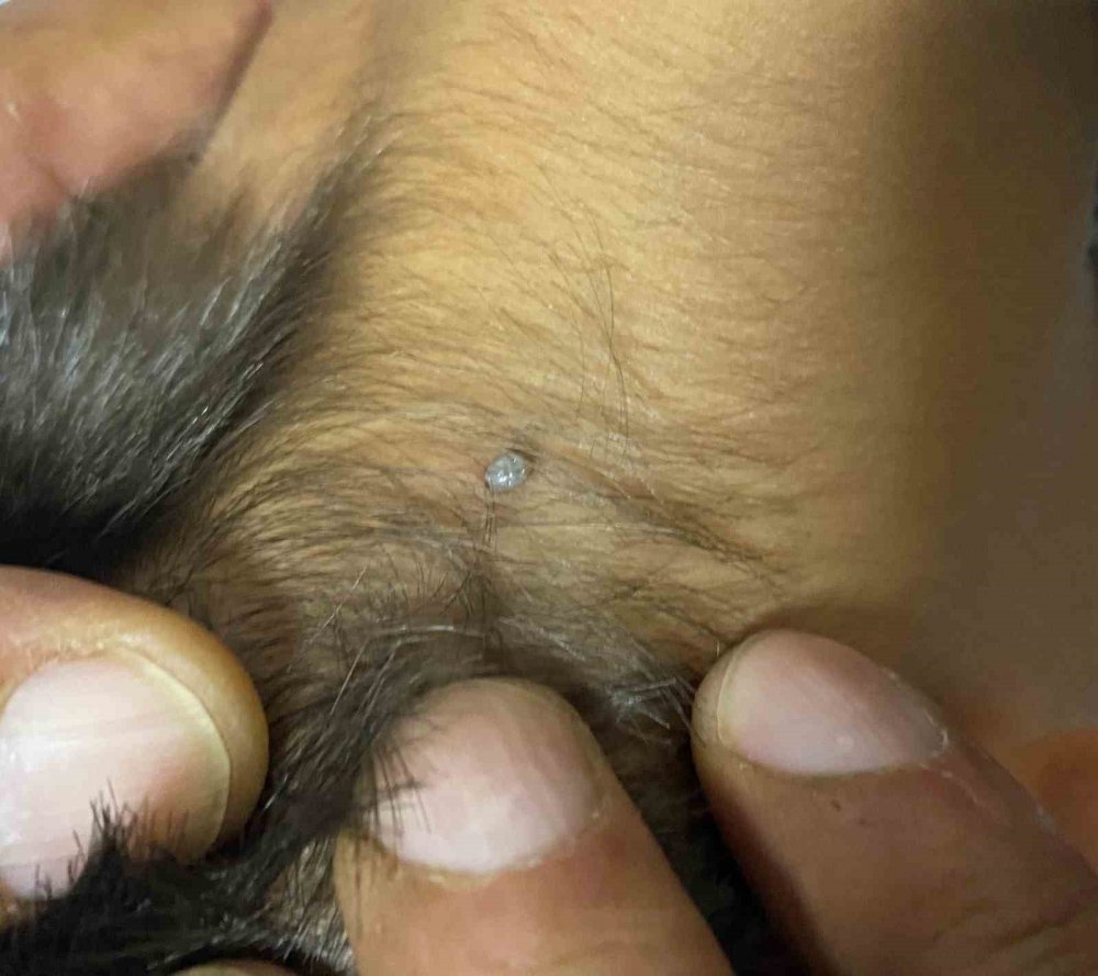 Konya’da kene kabusu! 4 yaşındaki çocuğa yapıştı