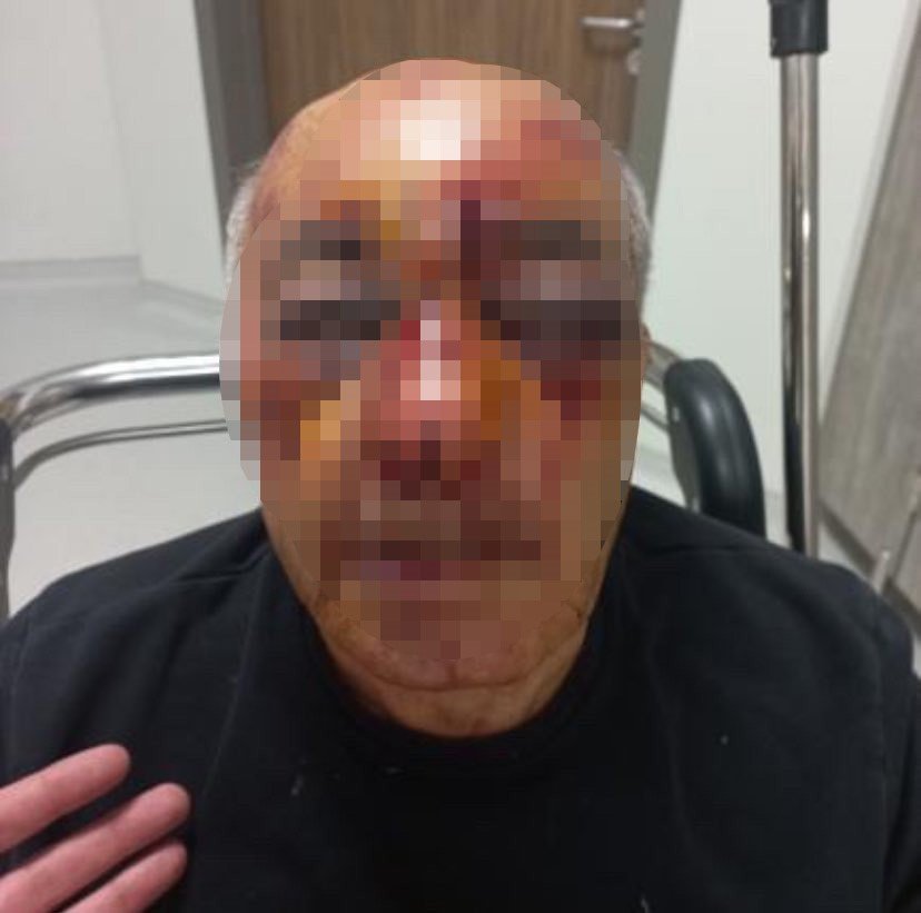 Gasp edilen taksiciye öldüresiye dayak kamerada