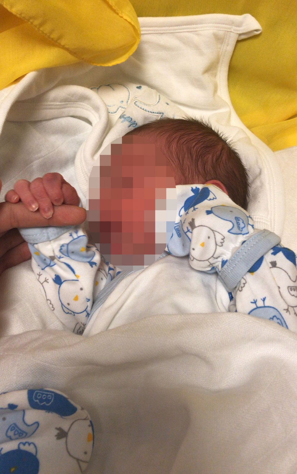 Bir hastanın vücudunda sargı bezi unutan doktordan ikinci vukuat