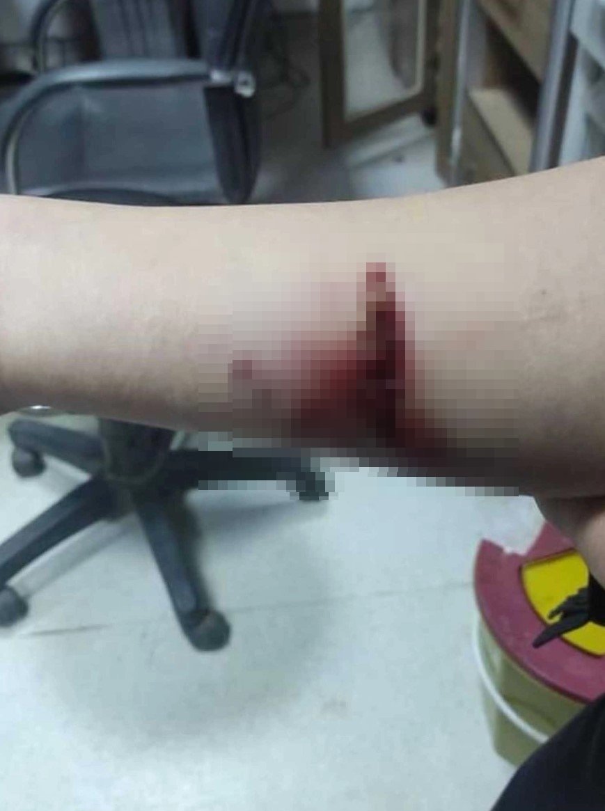 Başıboş köpeklerin saldırısına uğrayan çocuk yaralandı