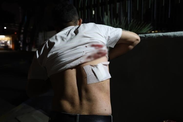 Taksiciden “Aracımı kapattım” cevabını alan yolcu, şoförün sırtına makas sapladı