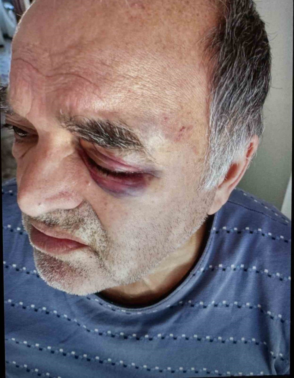 Okul müdürünün darp ettiği çift konuştu