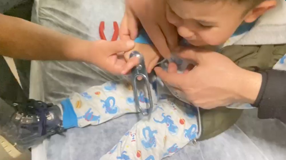 Parmağı meşrubat açacağına sıkışan çocuğu itfaiye kurtardı