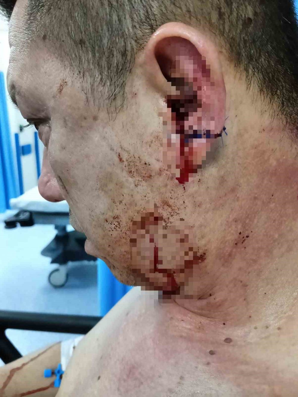 Başıboş köpek dehşeti kamerada...Oğlu için kendini feda etti