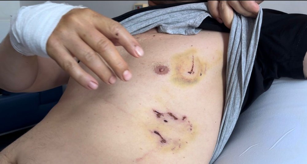 Başıboş köpek dehşeti kamerada...Oğlu için kendini feda etti