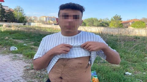 Konya'da parkta oturan gençlere 'Mahallenin namusunu kirlettiniz' diyerek hastanelik etti!