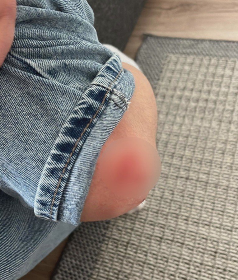 Ankara Mamak'ta 15 yaşındaki çocuğa sokak köpekleri saldırdı