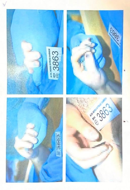 Cem Garipoğlu’nun otopsi görüntüleri ortaya çıktı